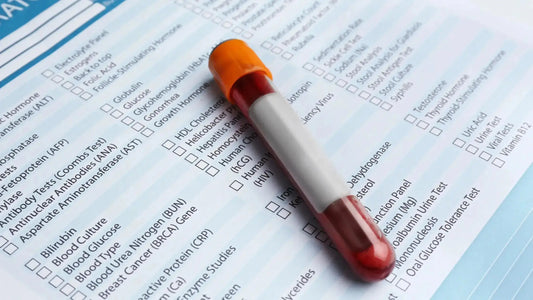10 Essential Blood Tests Every Adult Should Get