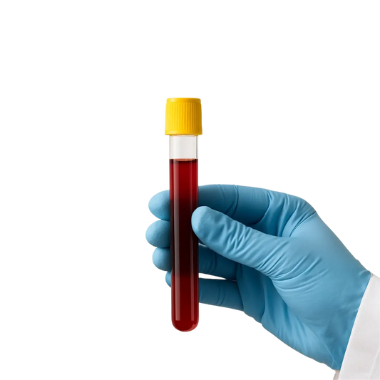 At-Home Phlebotomy Visit Epsom Blood Tests